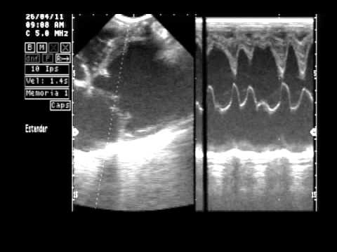 causas de la cardiomiopatía dilatada en perros