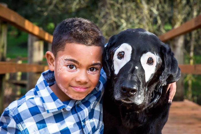 niño con vitiligo supera la depresión gracias a un perro