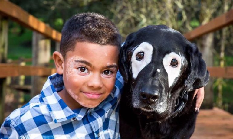niño con vitiligo supera la depresión gracias a un perro